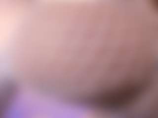 Lilacohen