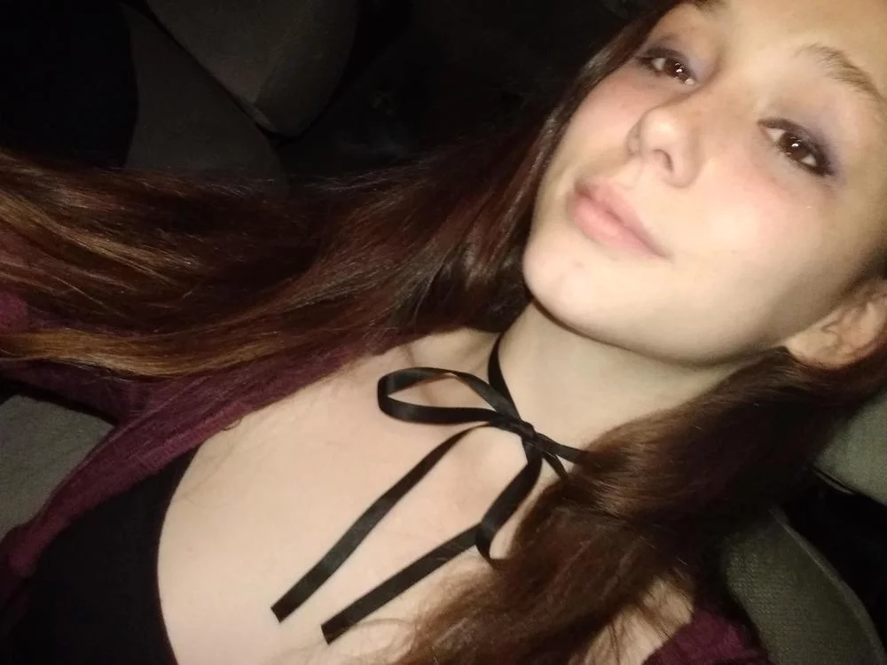freckledfoxxx