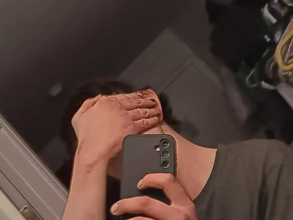 xxapollo