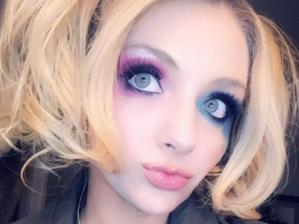 amputease