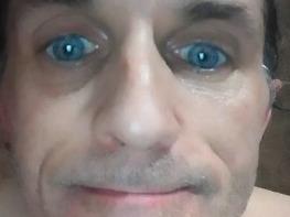 facenoxx