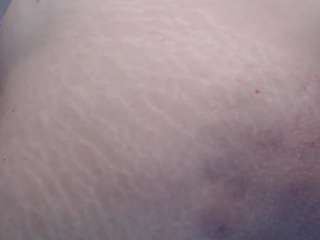 moertomlly