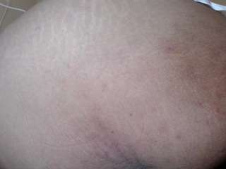 moertomlly live webcam show
