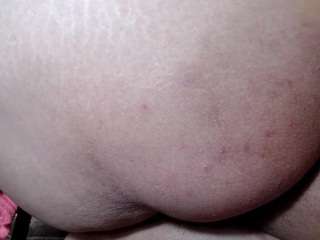 moertomlly