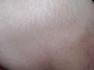 moertomlly