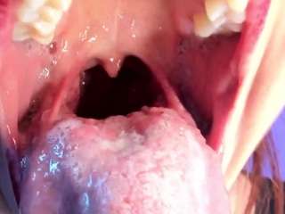 Katty-mouth