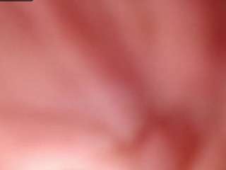cataleaa