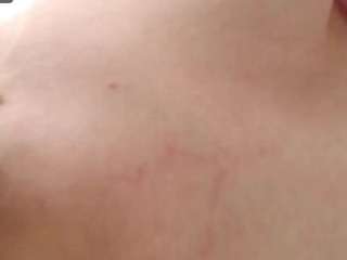 cataleaa
