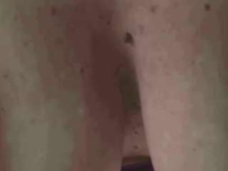 BonnieBotox