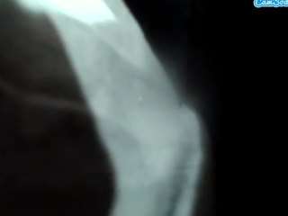 uncutelement0069