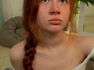 Profile of frecklediyana