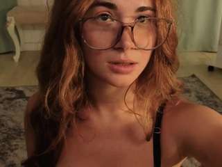 frecklediyana