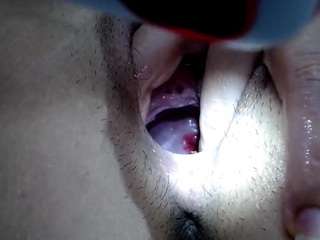 scolealia0