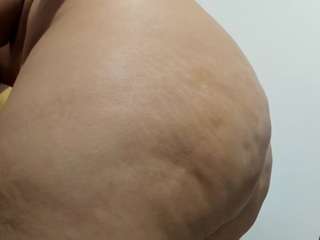 misseylenss