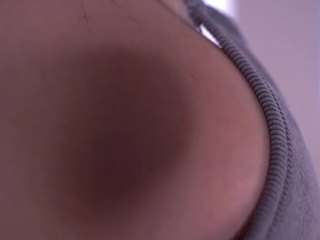 bellacle
