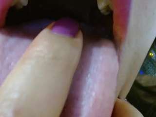 missevoleth2