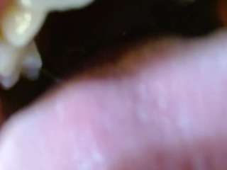 missevoleth2