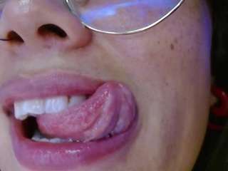 missevoleth2