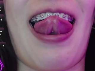 Anny