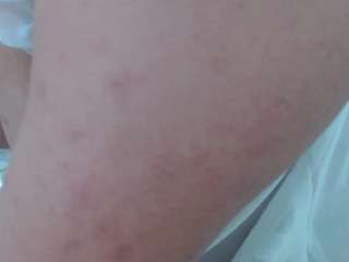 redveelvet25