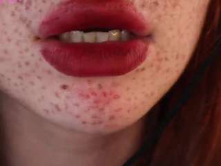 Killy-Merrot
