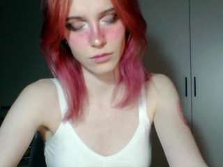 YonBenskin