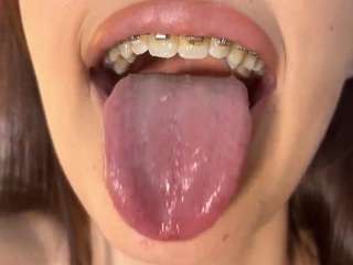 vesperrae